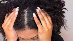 Causes of Dry, Flaky Scalp in African American Hair